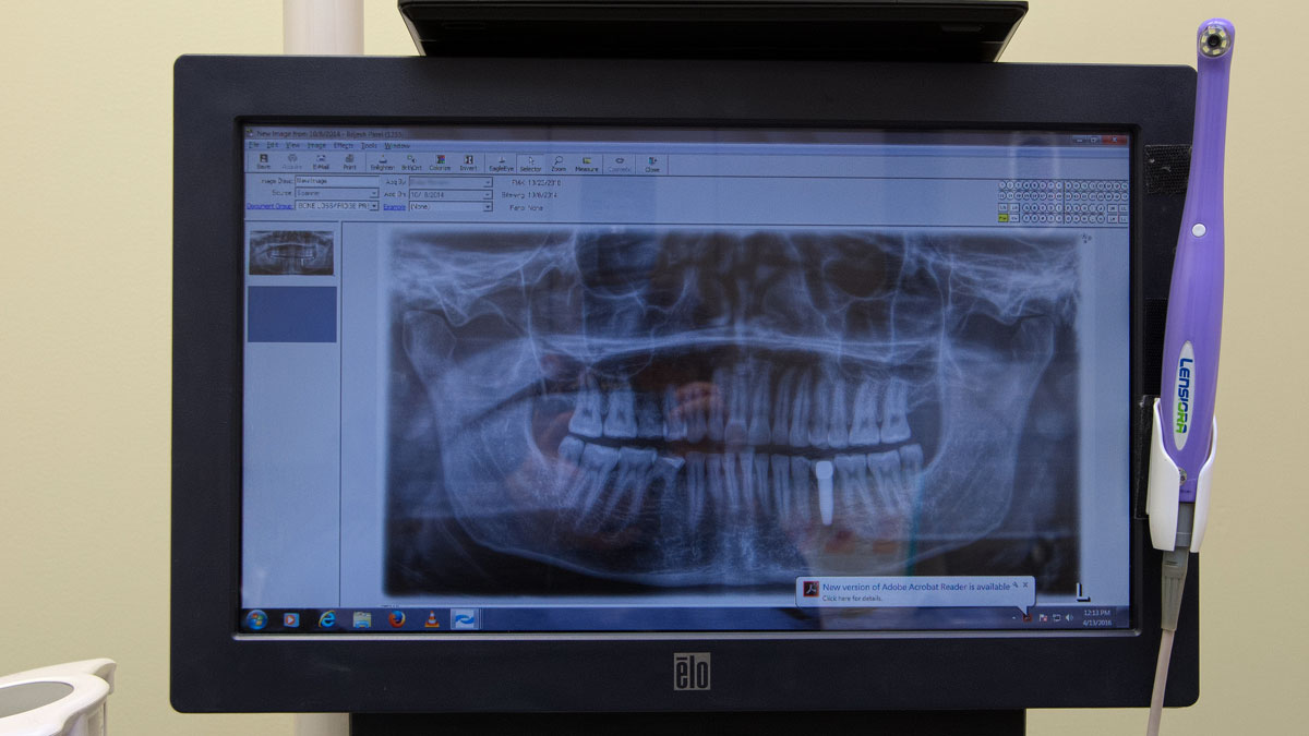 Let us improve your oral health at Morton Grove Dentistry, a high tech dentist near Park Ridge